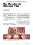 Class II Correction with the Invisalign System - Schupp