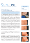 Coolsculpting From Zeltiq - Laser Surgery beirut Lebanon