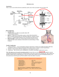 Hemodialysis