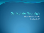 Geniculate Neuralgia