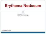 Erythema Nodosum UCSF Dermatology Last updated 10.25.10