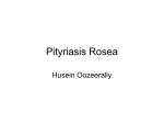 Pityriasis Rosea