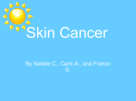 What is Skin Cancer?