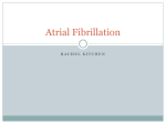 Atrial Fibrillation