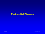 Pericarditis