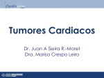 Tumores Cardiacos