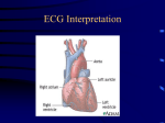 ECG Interpretation