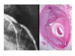 Gross cut surface Lung acute pulmonary congestion and edema