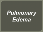 Pulmonary Edema