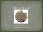 The Pacemaker