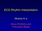 Sinus Bradycardia