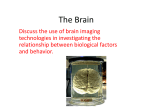 The Brain - AP Psychology Community