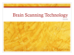 Brain Scanning Technology