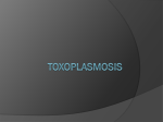 toxoplasmosis