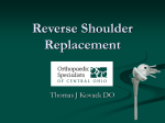 Shoulder Replacement