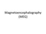 Magnetoencephalography