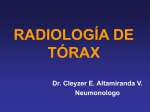 RADIOLOGÍA DE TÓRAX