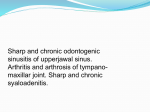 Inflamation of maxillary sinus