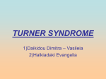 TURNER SYNDROME - Aristotle University of Thessaloniki