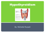 Hypothyroidism