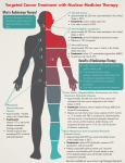 What is Radioisotope Therapy?