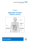 Stomach Cancer - Kettering General Hospital