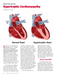 Hypertrophic Cardiomyopathy (HCM)